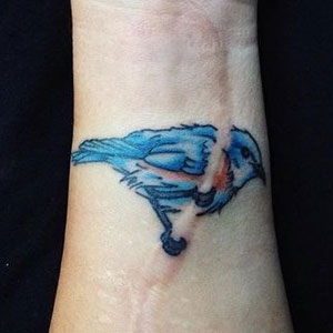 3 Reasons You Want to Get Treatment to Soften Your Scar Tissue